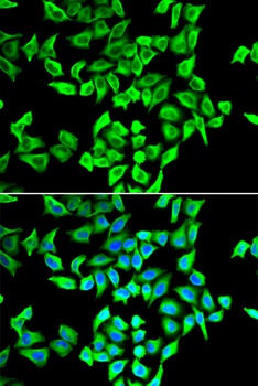 p53 Antibody