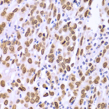 Lamin A/C Antibody