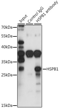 HSPB1 Antibody
