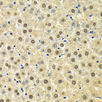 SPHK1 Antibody