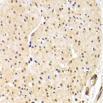 TERF1 Antibody