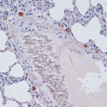 Perforin Antibody