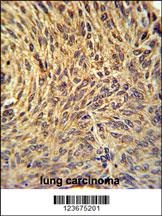 NUP210 Antibody