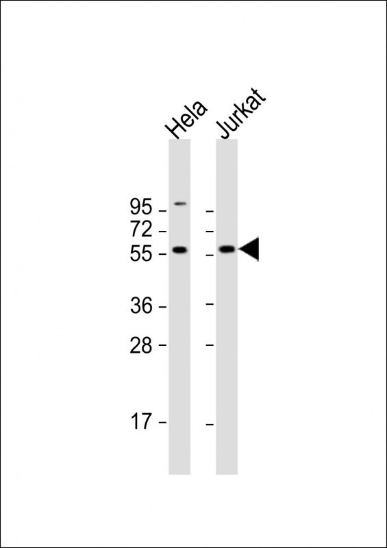 CREB3L2 Antibody