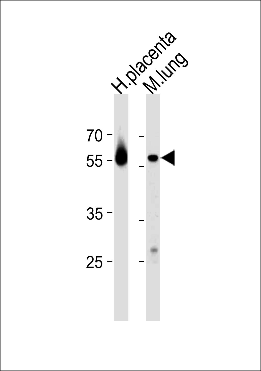 CREB3L2 Antibody