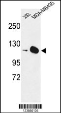 DIAPH2 Antibody