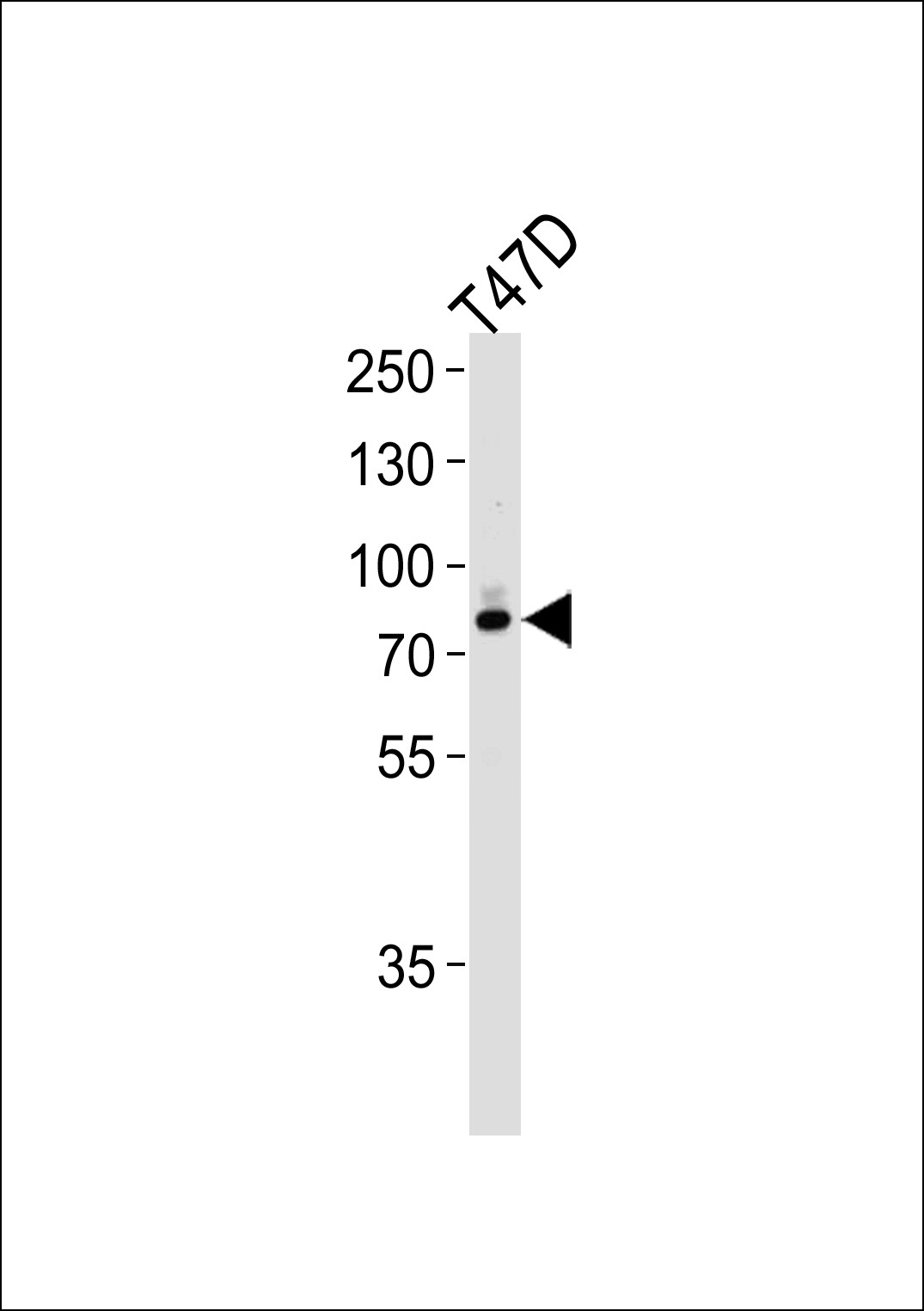 EXT2 Antibody