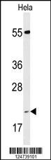 PPIC Antibody