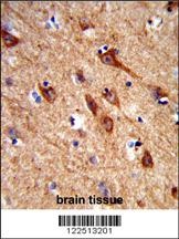 ACCN1 Antibody