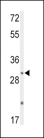 DUSP2 Antibody
