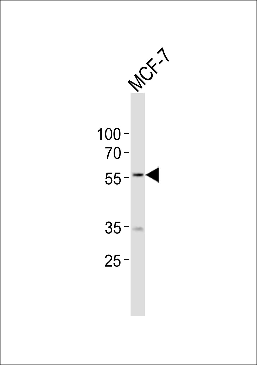NAMPT Antibody