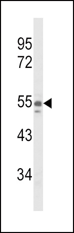 NAMPT Antibody