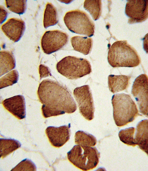 NAMPT Antibody