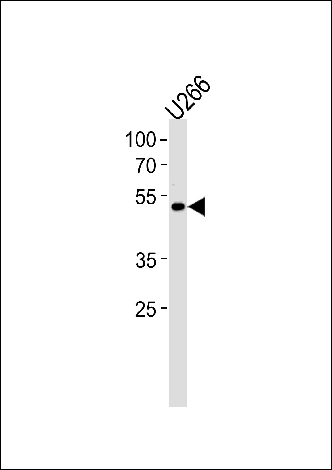 ETV6 Antibody