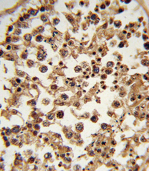 ETV6 Antibody