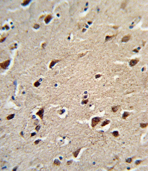 OAT Antibody