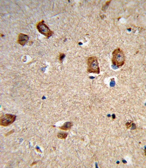 ITGA1 Antibody