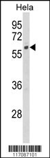 CYP7B1 Antibody
