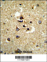CYP7B1 Antibody