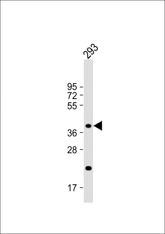 CSGALNACT2 Antibody