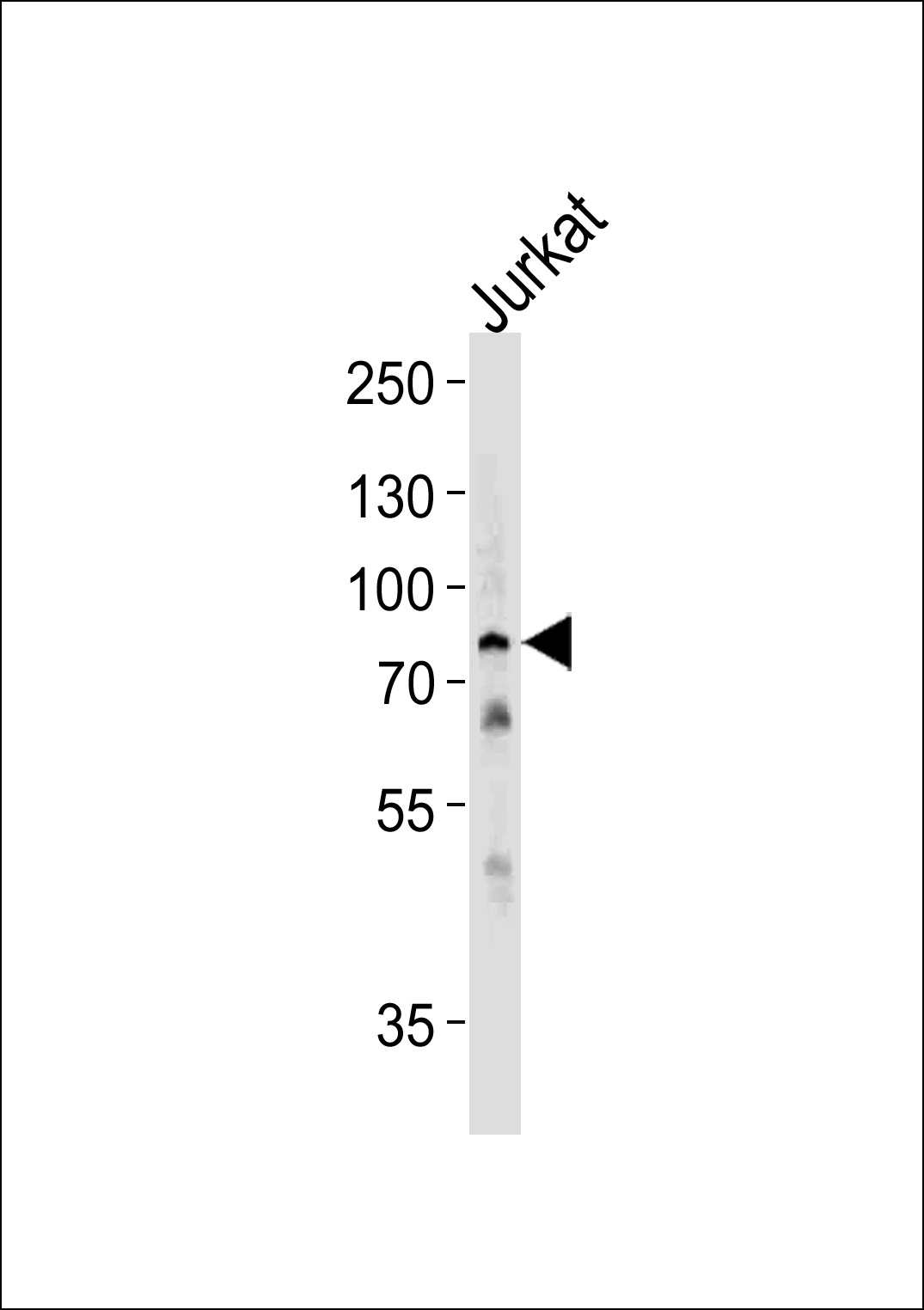 HSPA6 Antibody