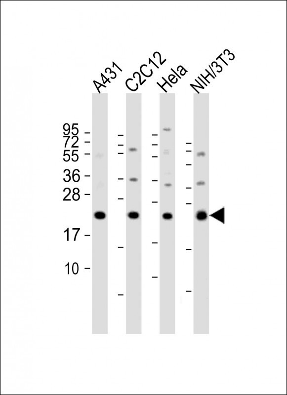 RAB7 Antibody