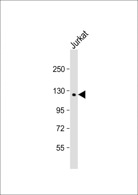 PTPD1 Antibody