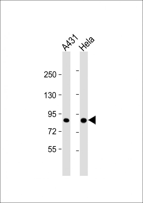 TLK1 Antibody