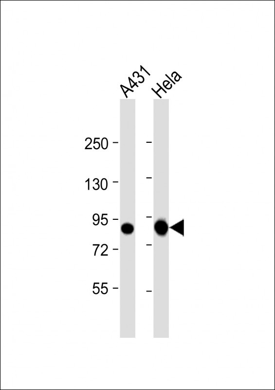 TLK1 Antibody
