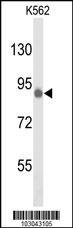 TLK1 Antibody