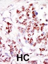 TLK1 Antibody
