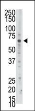 PAPSS2 Antibody