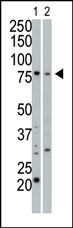 cGKI Antibody