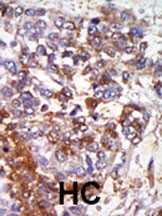 cGKI Antibody