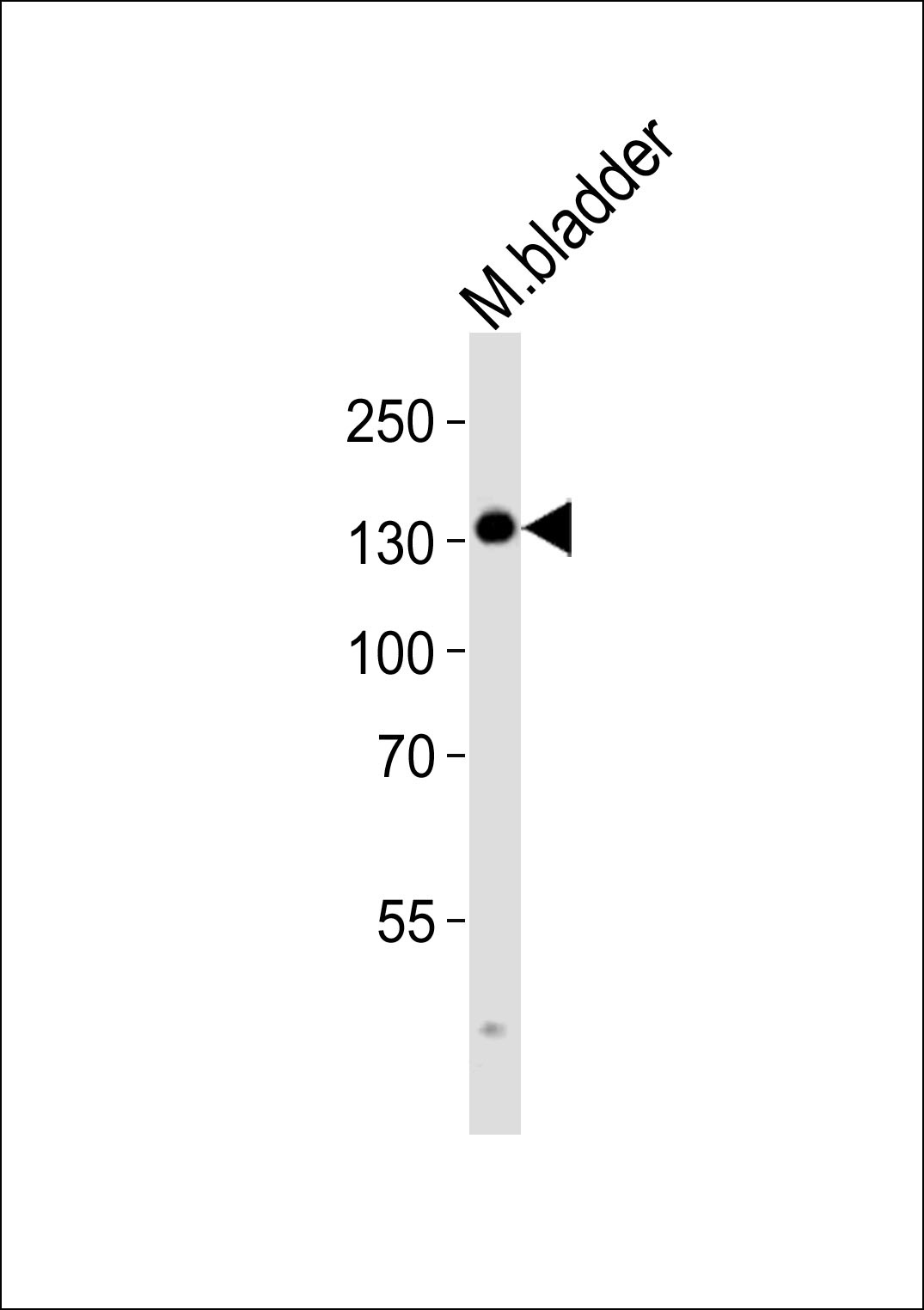 MLCK Antibody