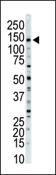 MLCK Antibody