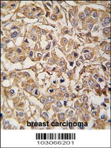 MYLK3 Antibody