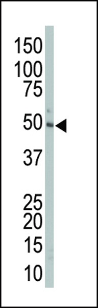 MEK2 Antibody