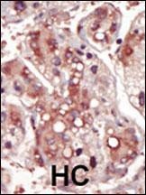 MEK2 Antibody