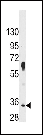 PIM2 Antibody