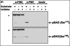 PIM2 Antibody