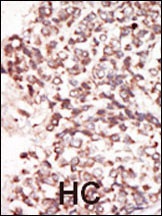 PIM2 Antibody