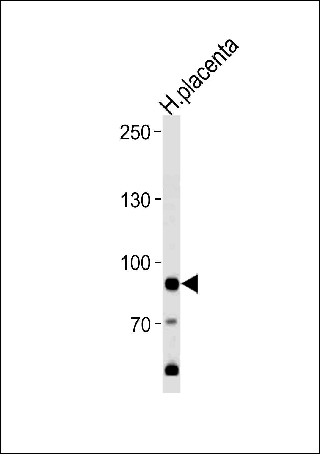 AMPD3 Antibody
