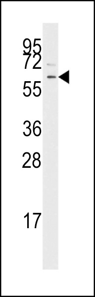 TGF Beta Receptor I Antibody