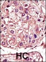 TGF Beta Receptor I Antibody