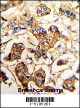 ACTN4 Antibody