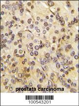 MEN1 Antibody