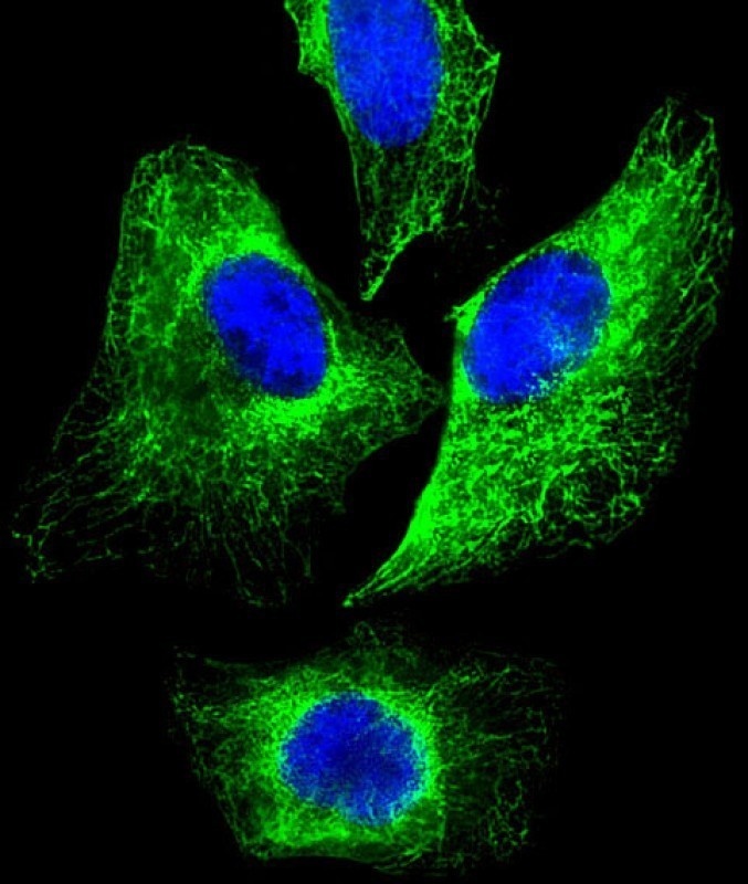 CYK18 Antibody