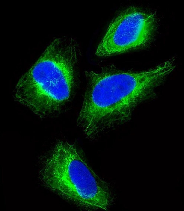 CYK18 Antibody