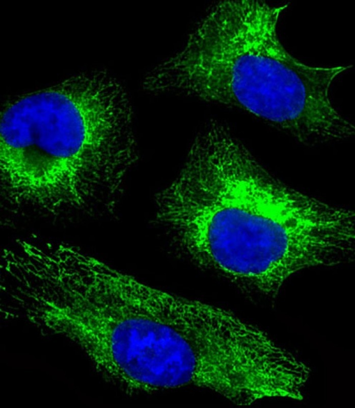 CYK18 Antibody
